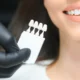 teeth whitening