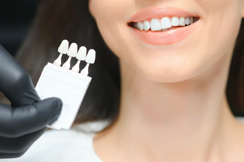 teeth whitening